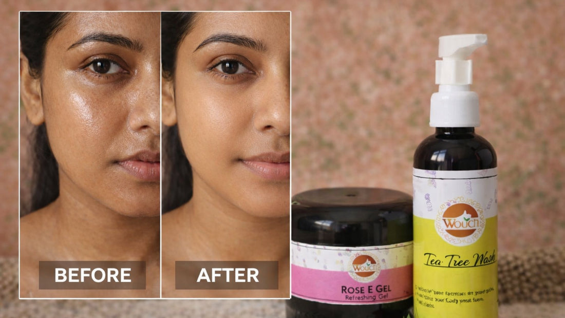 Best Skincare Routine for Oily Skin in India (Step-by-Step Guide)