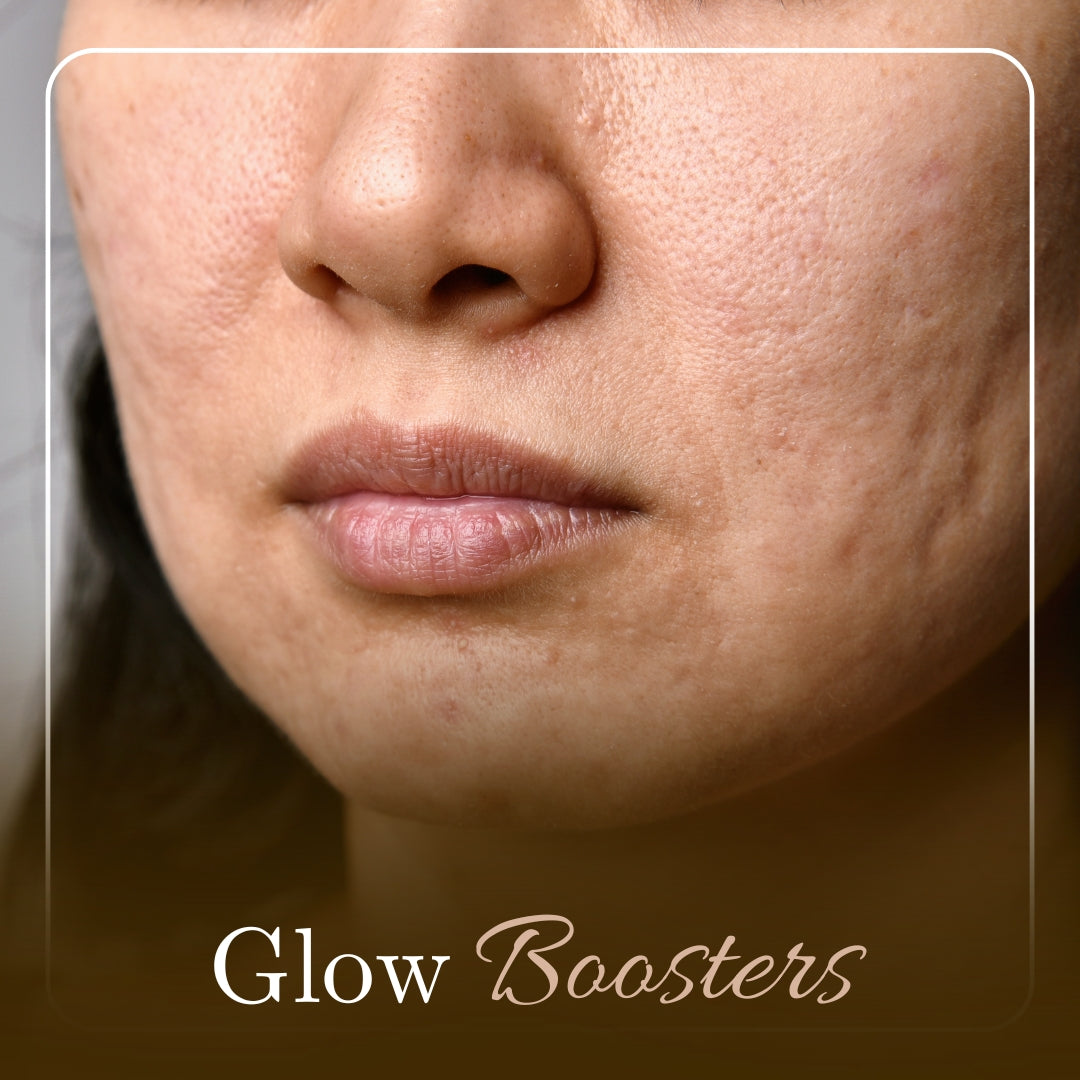 Glow Boosters